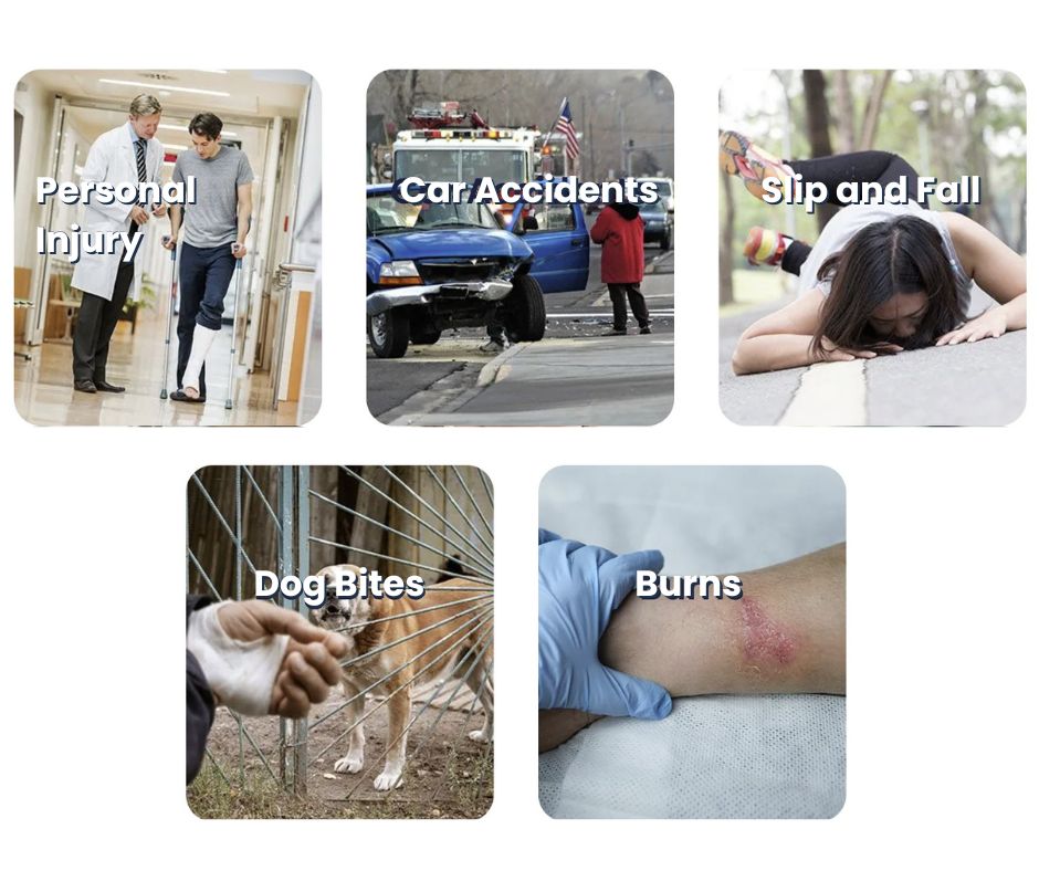 pagano-law-personal-injury-car-accidents-slip-and-fall-dog-bites-burns